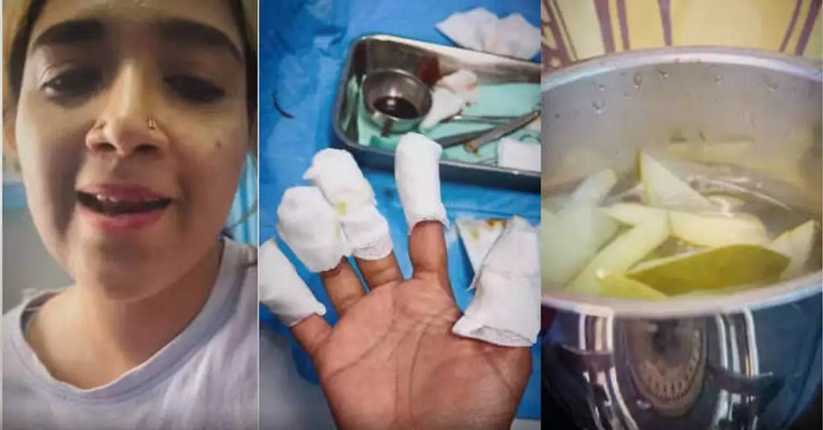 ഫുഡ് വ്‌ളോഗിംഗ് ചെയ്യുന്നതിനിടെ മിക്‌സി പൊട്ടിത്തെറിച്ച് നടിയും ഗായികയുമായ അഭിരാമി സുരേഷിന് പരിക്കേറ്റു