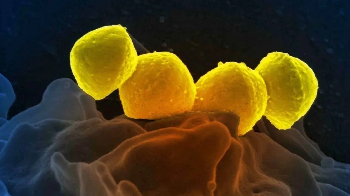 japan-reports-record-spike-in-potentially-deadly-bacterial-infection